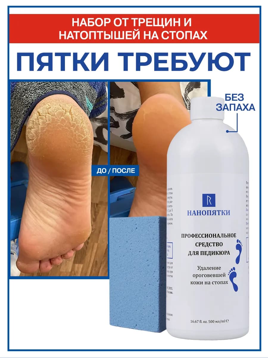 Набор для пяток от трещин