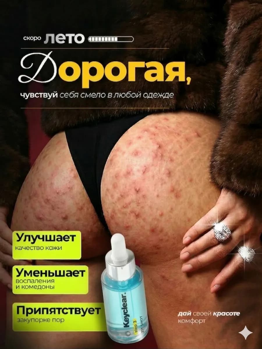 Сыворотка с ниацинамидом от прыщей и черных точек