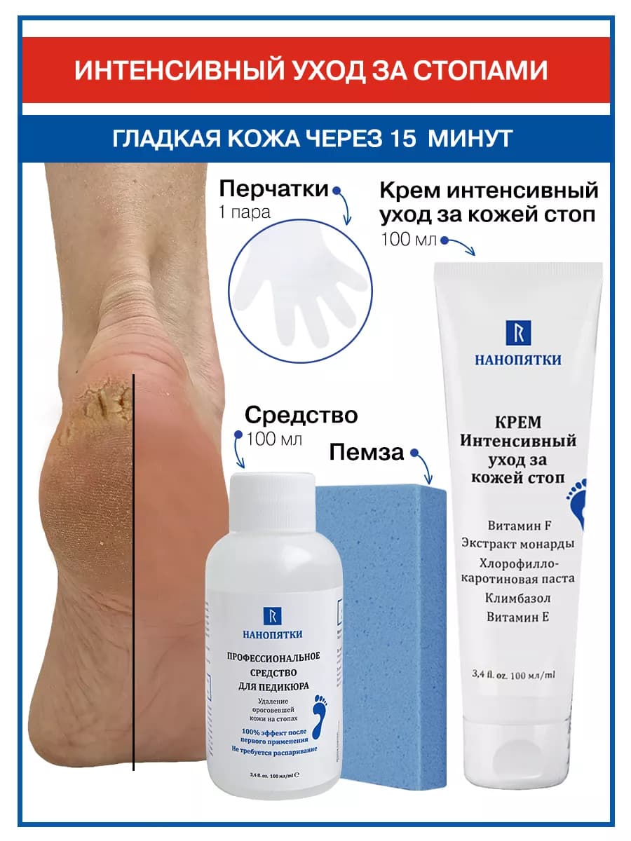 Средство от натоптышей и трещин. Гладкие пятки