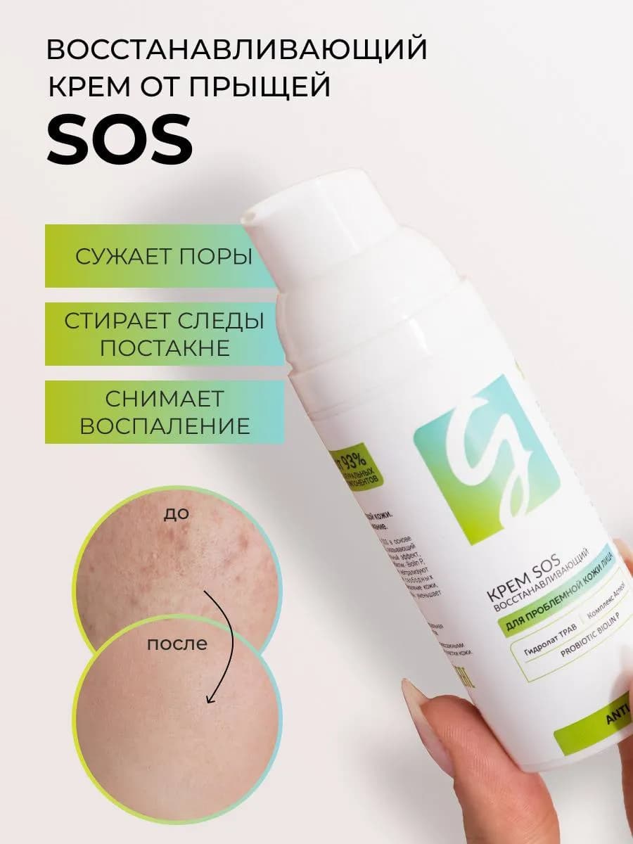 Крем для лица от прыщей