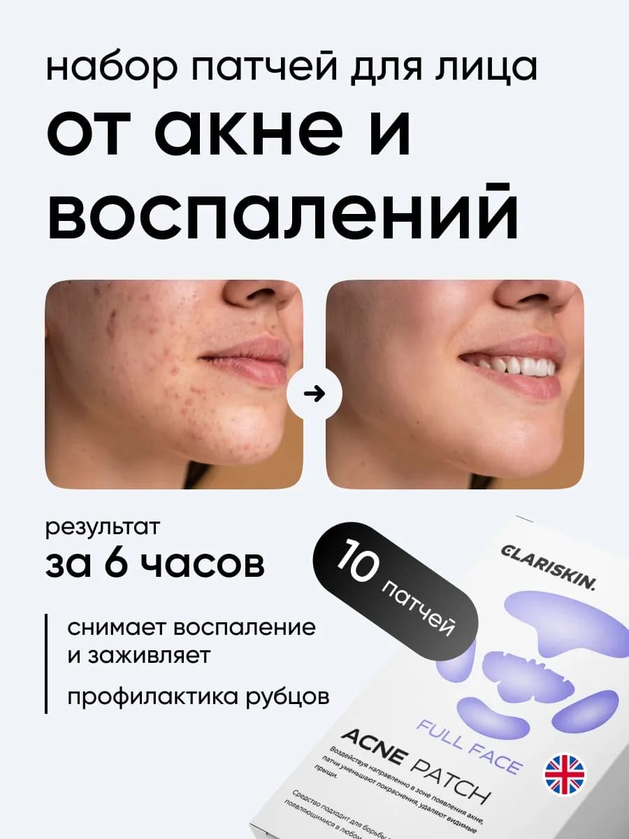Патчи от прыщей для лица