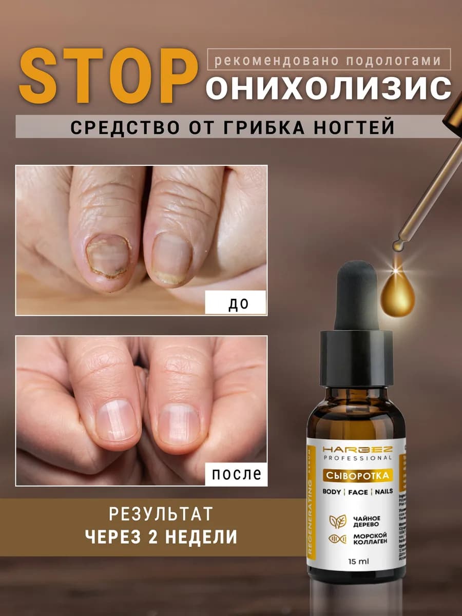 Средство от грибка ногтей стоп онихолизис 15 мл