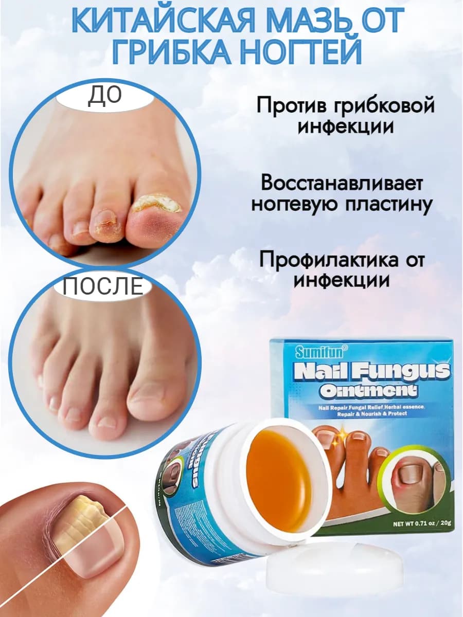 Китайское Средство от грибка ногтей