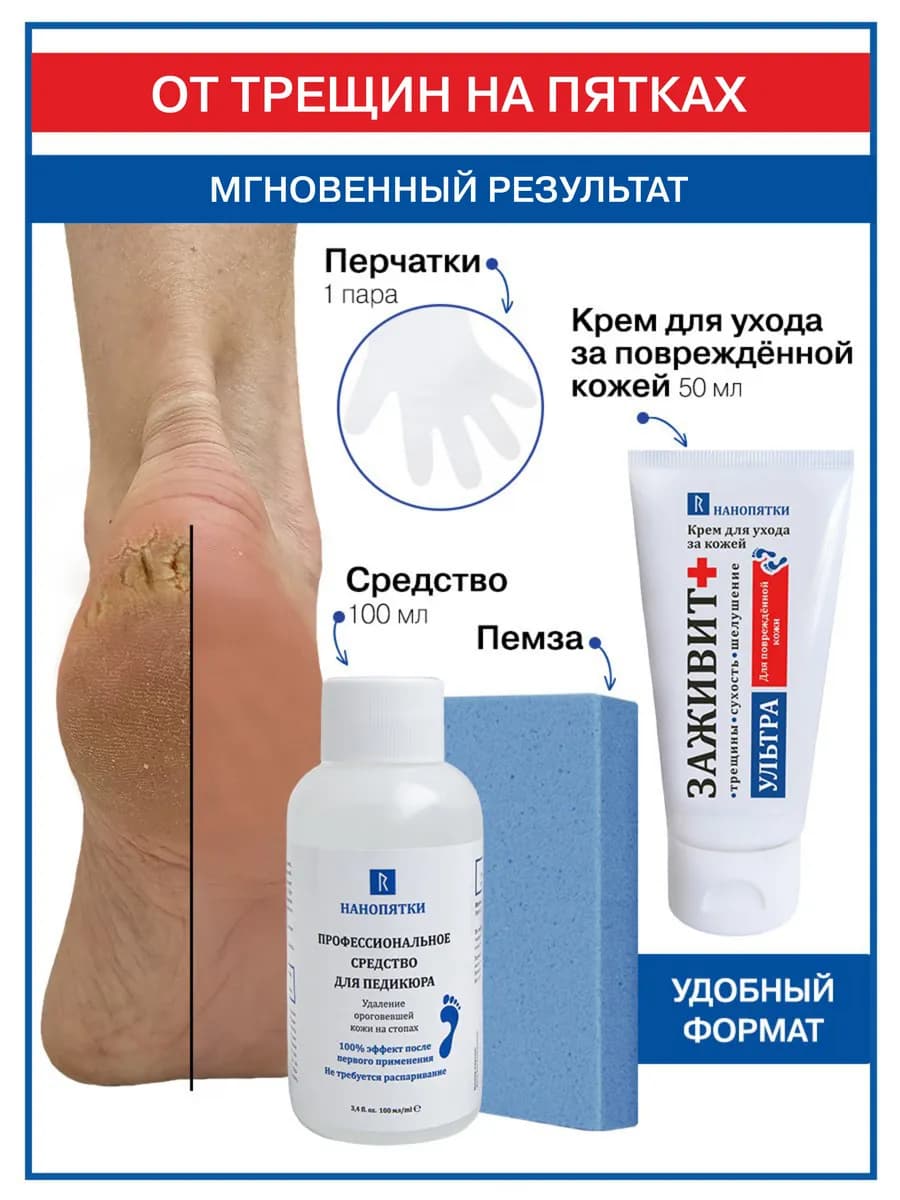 Крем и средство для пяток от трещин