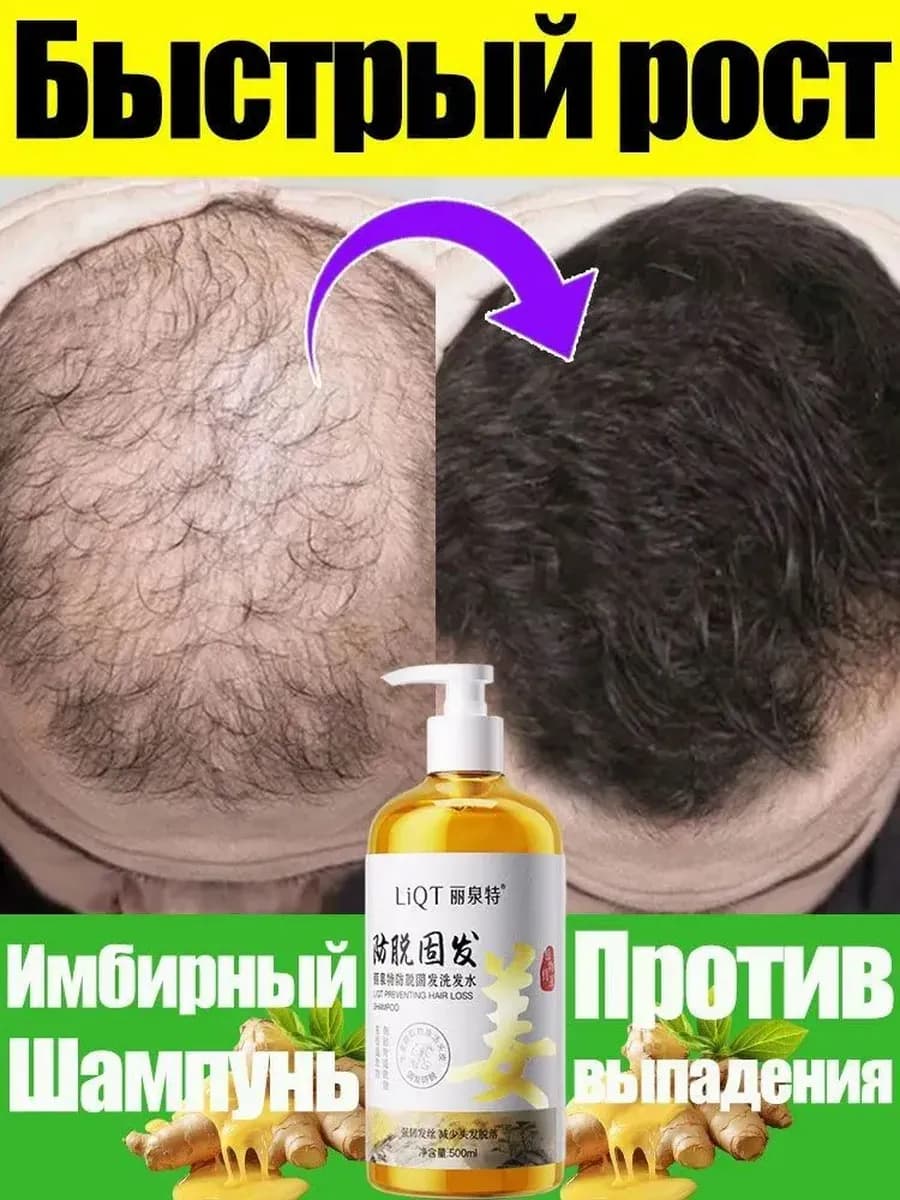 Шампунь для роста волос и против выпадения