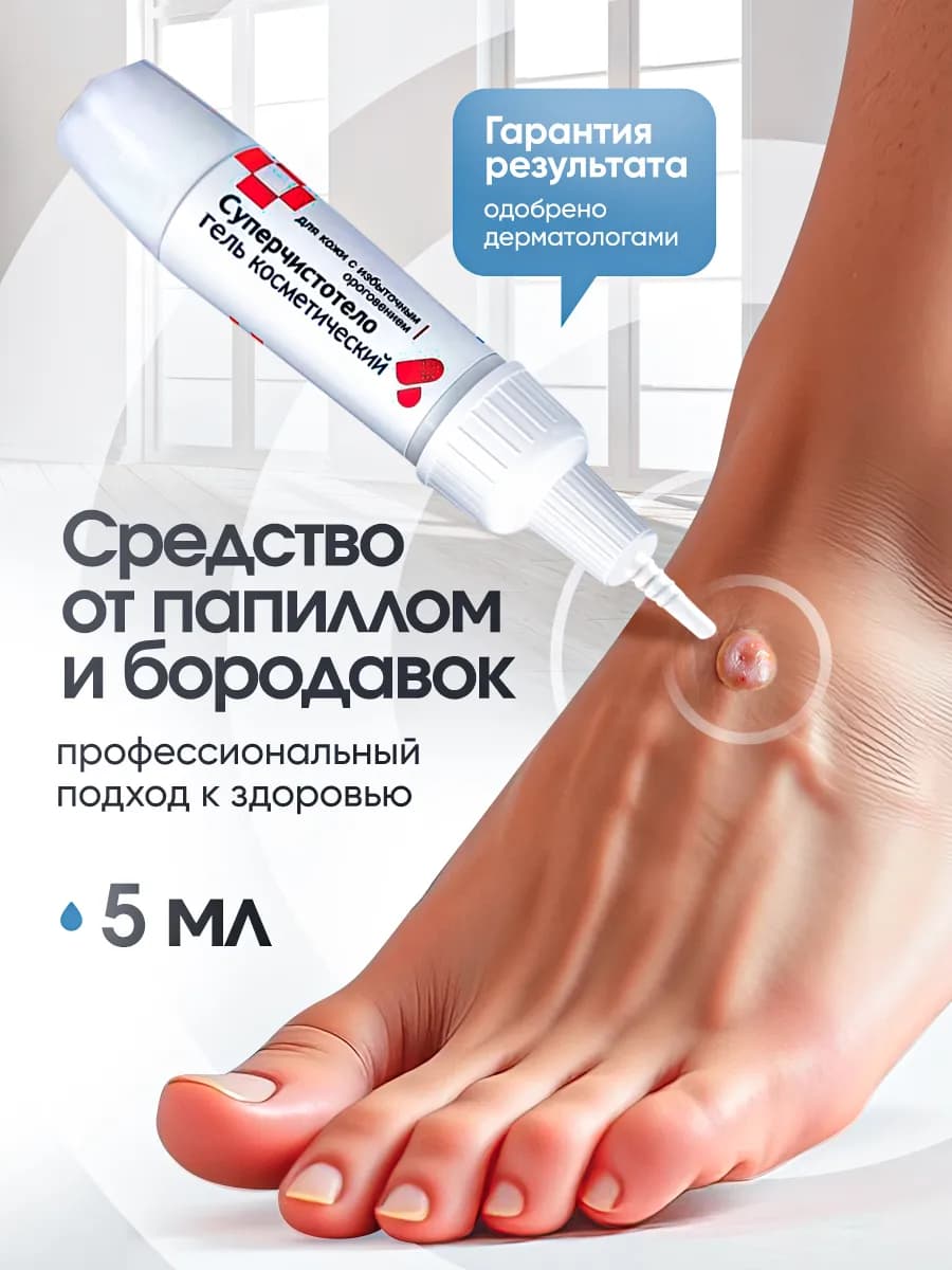 Чистотел от папиллом и бородавок гель косметический